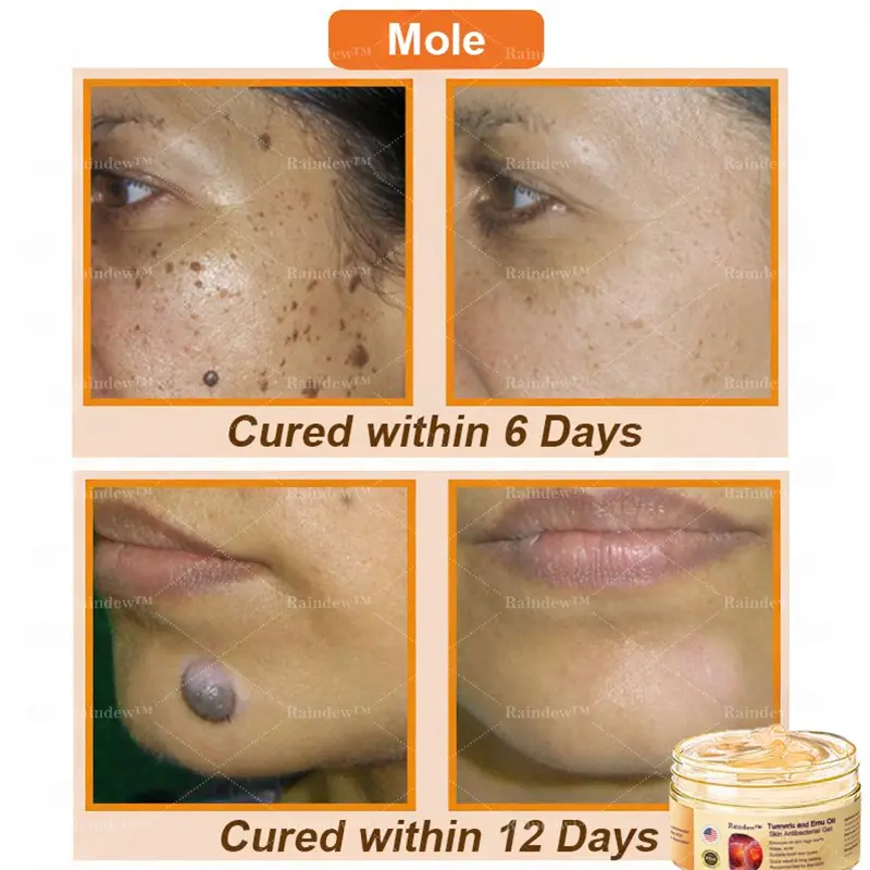 Raindew™ Turmeric and Emu Oil Skin Antibacterial Gel