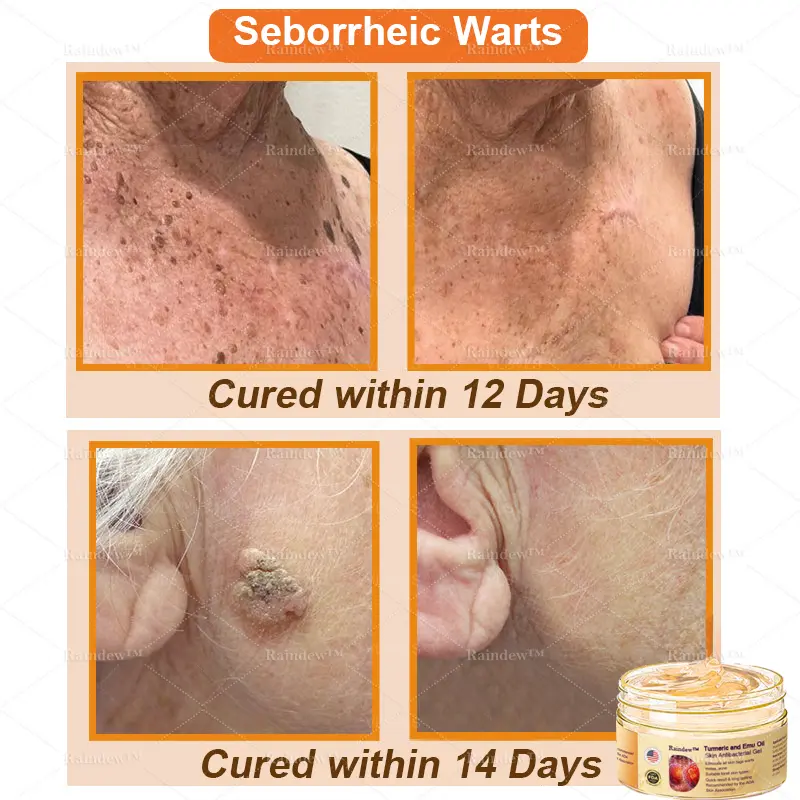 Raindew™ Turmeric and Emu Oil Skin Antibacterial Gel