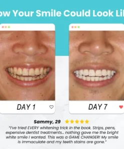 Remifa™ SpeedySmile EZBrush 360 U-Shape Toothbrush