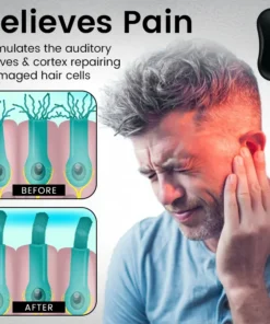 STARYEST™ Tinnitus Relief Device Serenity