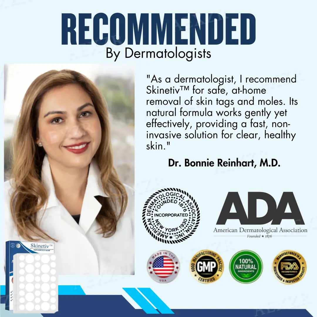 Skinetiv™ пластир за премахване на бенки и брадавици