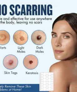 Skinetiv™ пластир за премахване на бенки и брадавици