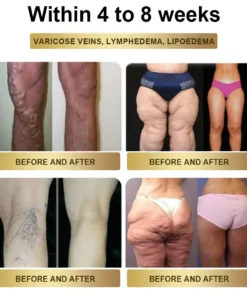 TOOYES® Metatrolide GLP-1 activation Herbal Oral Liquid