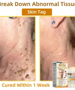 𝐀𝐞𝐞𝐡𝐟𝐞𝐧𝐠® 𝐁𝐎𝐓𝐎𝐗 𝐁𝐞𝐞 𝐕𝐞𝐧𝐨𝐦 𝐒𝐤𝐢𝐧 𝐑𝐞𝐩𝐚𝐢𝐫 𝐂𝐫𝐞𝐚𝐦