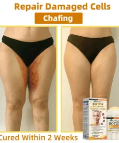 𝐀𝐞𝐞𝐡𝐟𝐞𝐧𝐠® 𝐁𝐎𝐓𝐎𝐗 𝐁𝐞𝐞 𝐕𝐞𝐧𝐨𝐦 𝐒𝐤𝐢𝐧 𝐑𝐞𝐩𝐚𝐢𝐫 𝐂𝐫𝐞𝐚𝐦