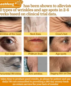 𝐀𝐞𝐞𝐡𝐟𝐞𝐧𝐠® 𝐁𝐎𝐓𝐎𝐗 𝐁𝐞𝐞 𝐕𝐞𝐧𝐨𝐦 𝐒𝐤𝐢𝐧 𝐑𝐞𝐩𝐚𝐢𝐫 𝐂𝐫𝐞𝐚𝐦