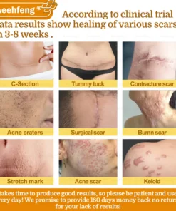 𝐀𝐞𝐞𝐡𝐟𝐞𝐧𝐠® 𝐁𝐎𝐓𝐎𝐗 𝐁𝐞𝐞 𝐕𝐞𝐧𝐨𝐦 𝐒𝐤𝐢𝐧 𝐑𝐞𝐩𝐚𝐢𝐫 𝐂𝐫𝐞𝐚𝐦