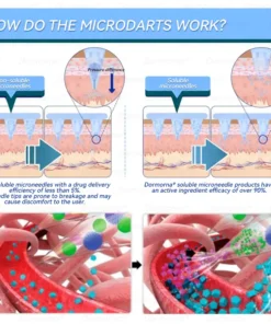 𝐷𝑜𝑟𝑚𝑜𝑟𝑛𝑎® 𝑁𝐻𝑀𝑅𝐶-𝑇𝑖𝑟𝑧𝑒𝑝𝑎𝑡𝑖𝑑𝑒 𝑁𝑎𝑛𝑜 𝑀𝑖𝑐𝑟𝑜𝑛𝑒𝑒𝑑𝑙𝑒 𝑃𝑎𝑡𝑐ℎ