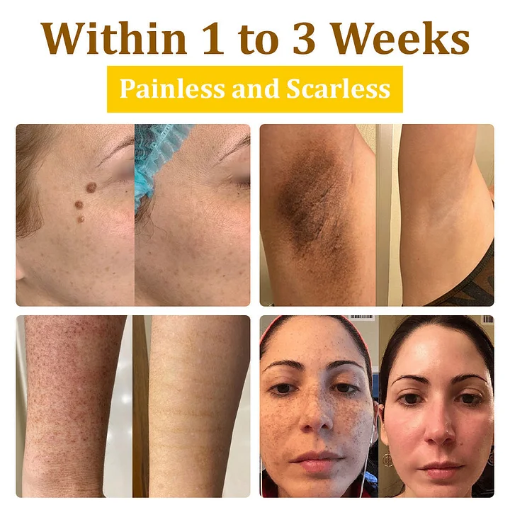 Haplos™ Bee Venom Treatment Cream - Image 11