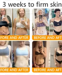 APKAPK® Bee Venom Botox Skin Renewal Cream