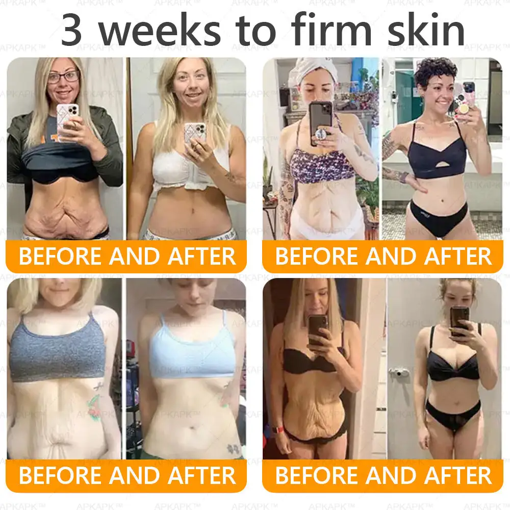 APKAPK® Bee Venom Botox Skin Renewal Cream