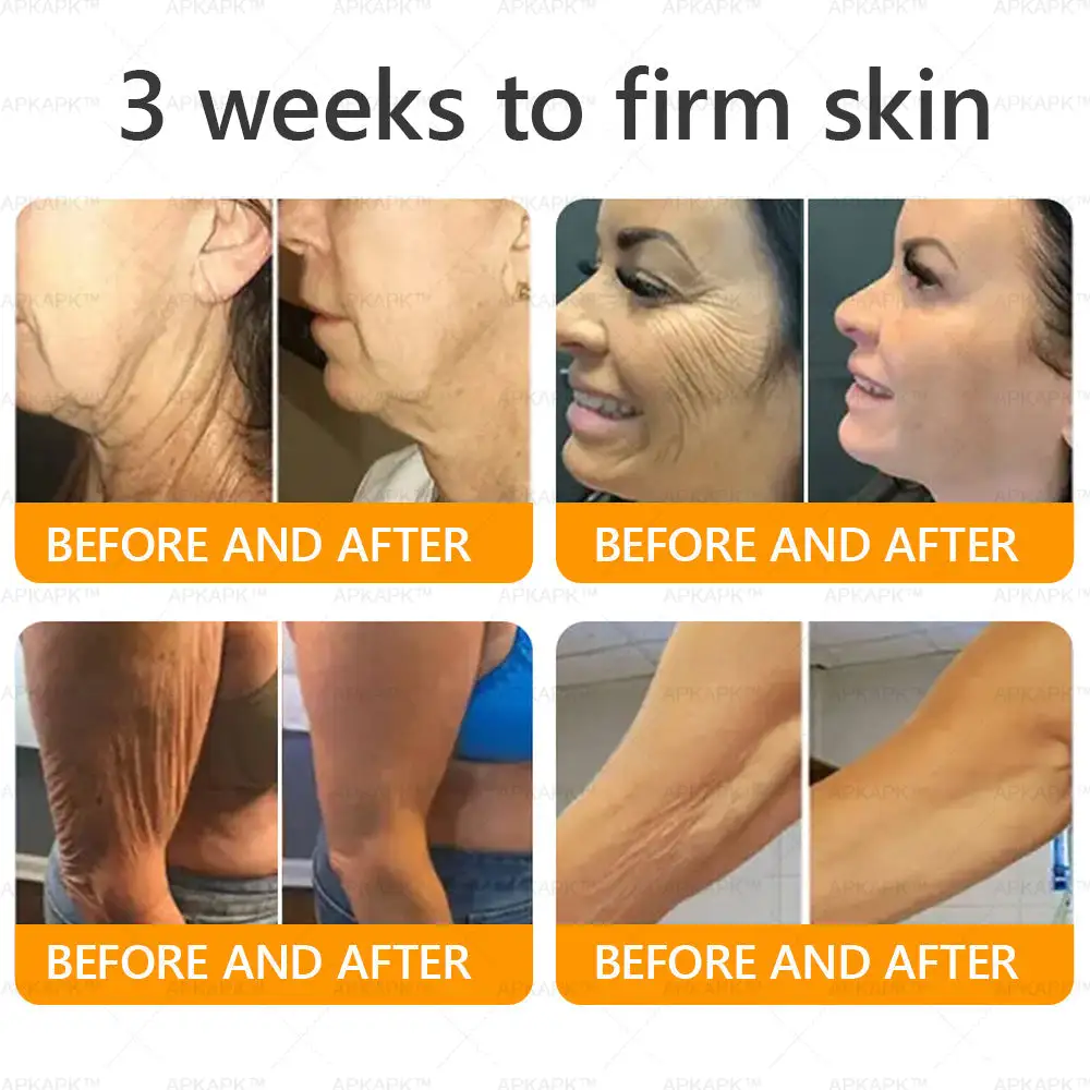 APKAPK® Bee Venom Botox Skin Renewal Cream