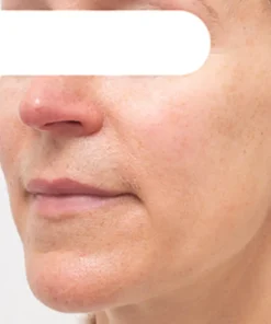 AQA™ Herbal Spots Peel-Off Facial Mask