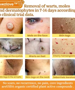 Awzlove™ Botox Bee Venom Rapid Skin Repair Cream