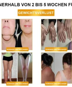 CZTICLE® Ultrasound Fat Reduction & Far Infrared Blood Sugar Balance