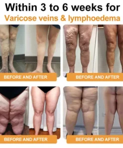 CZTICLE® Ultrasound Fat Reduction & Far Infrared Blood Sugar Balance