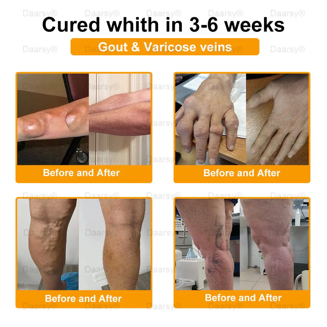 Daasry™ Botulinum Toxin & Bee Venom Pain-Relief Bone Healing Cream