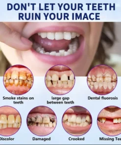 DentureGlow™ –🦷Get a Perfect Smile Fast!🦷 (⏰30-Min Flash Sale Ends Soon!⏰)