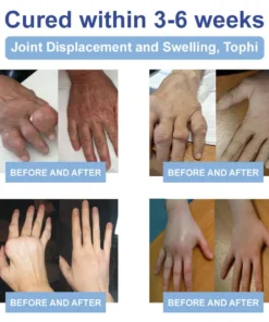 FATONG® Magnesium Pain Healing Bone Cream