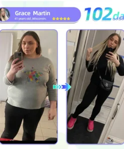 Fubsta® SMGT-GLP-1 Nano Microneedle Patch