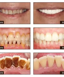 JEREMYTIS™ Ultra Whitening Mint Toothpaste