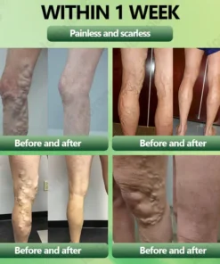 JORONDY® Horse Chestnut Vein Cream