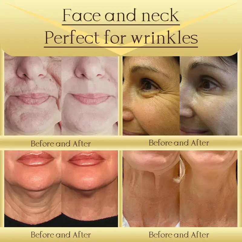 Jorondy® AH-8 Skin Firming Cream