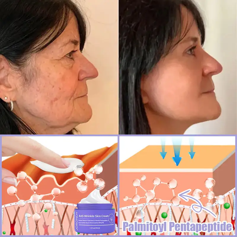 Jorondy® Anti-Wrinkle Skin Cream