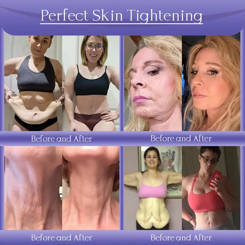 Jorondy® Anti-Wrinkle Skin Cream