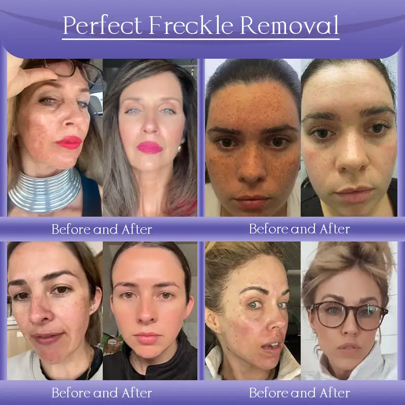 Jorondy® Anti-Wrinkle Skin Cream