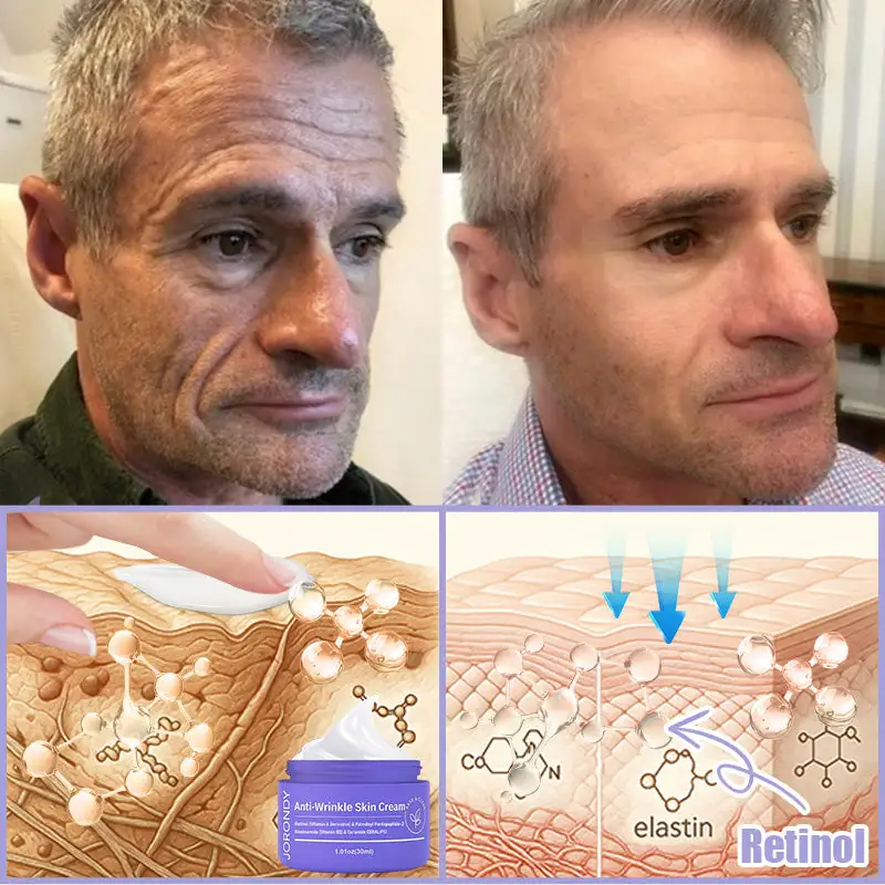 Jorondy® Anti-Wrinkle Skin Cream