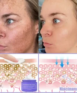 Jorondy® Anti-Wrinkle Skin Cream