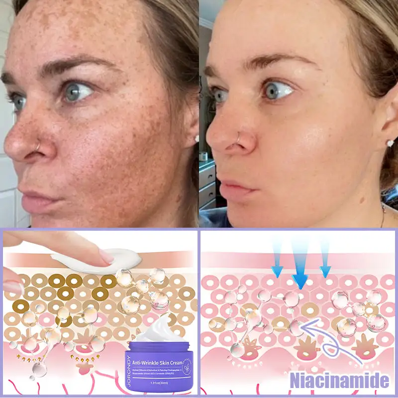 Jorondy® Anti-Wrinkle Skin Cream