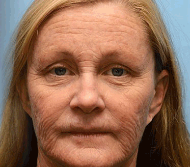 Jorondy® Instant skin tightening Cream