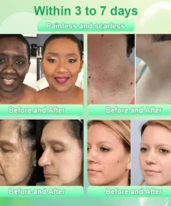 Jorondy® Purifying Exfoliating Gel