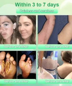 Jorondy® Purifying Exfoliating Gel