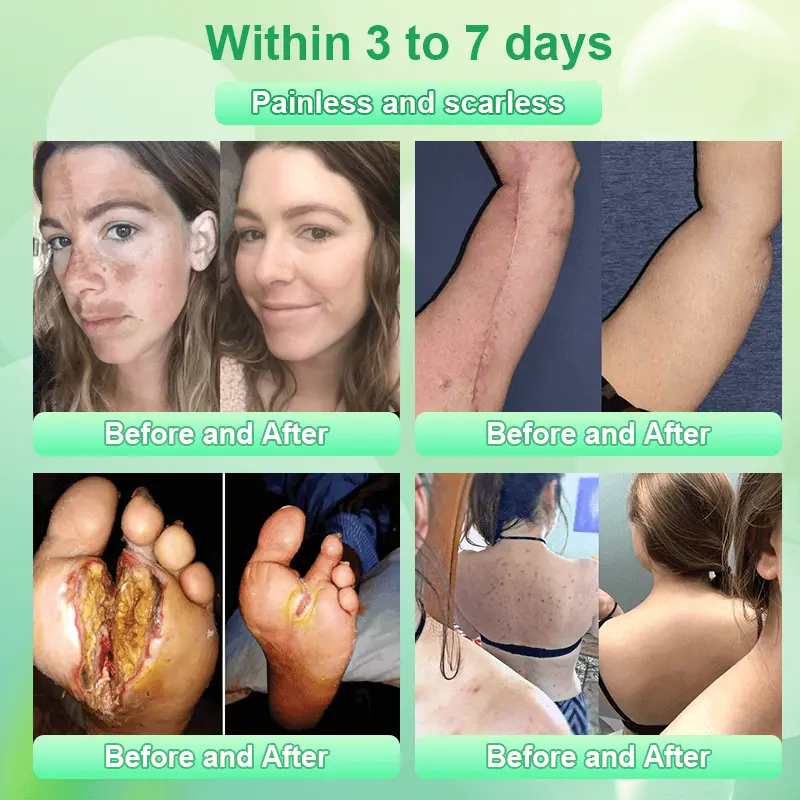 Jorondy® Purifying Exfoliating Gel