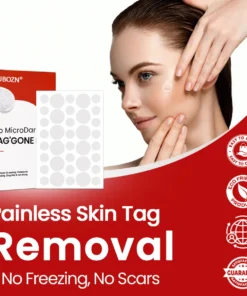 KUBOZN® Pro MicroDarts TAG'Gone Patch