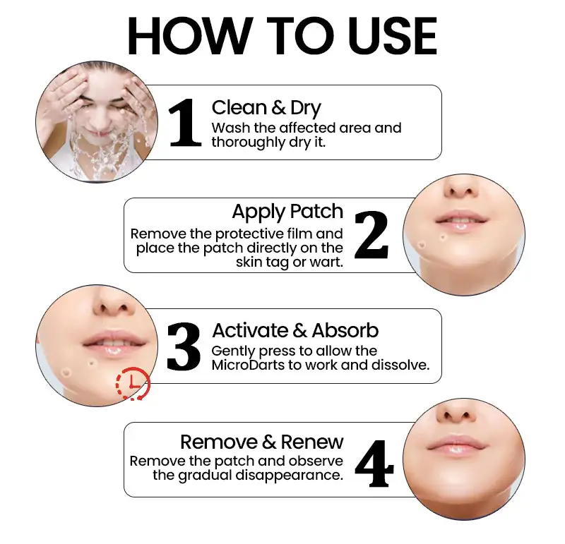 KUBOZN® Pro MicroDarts TAG'Gone Patch