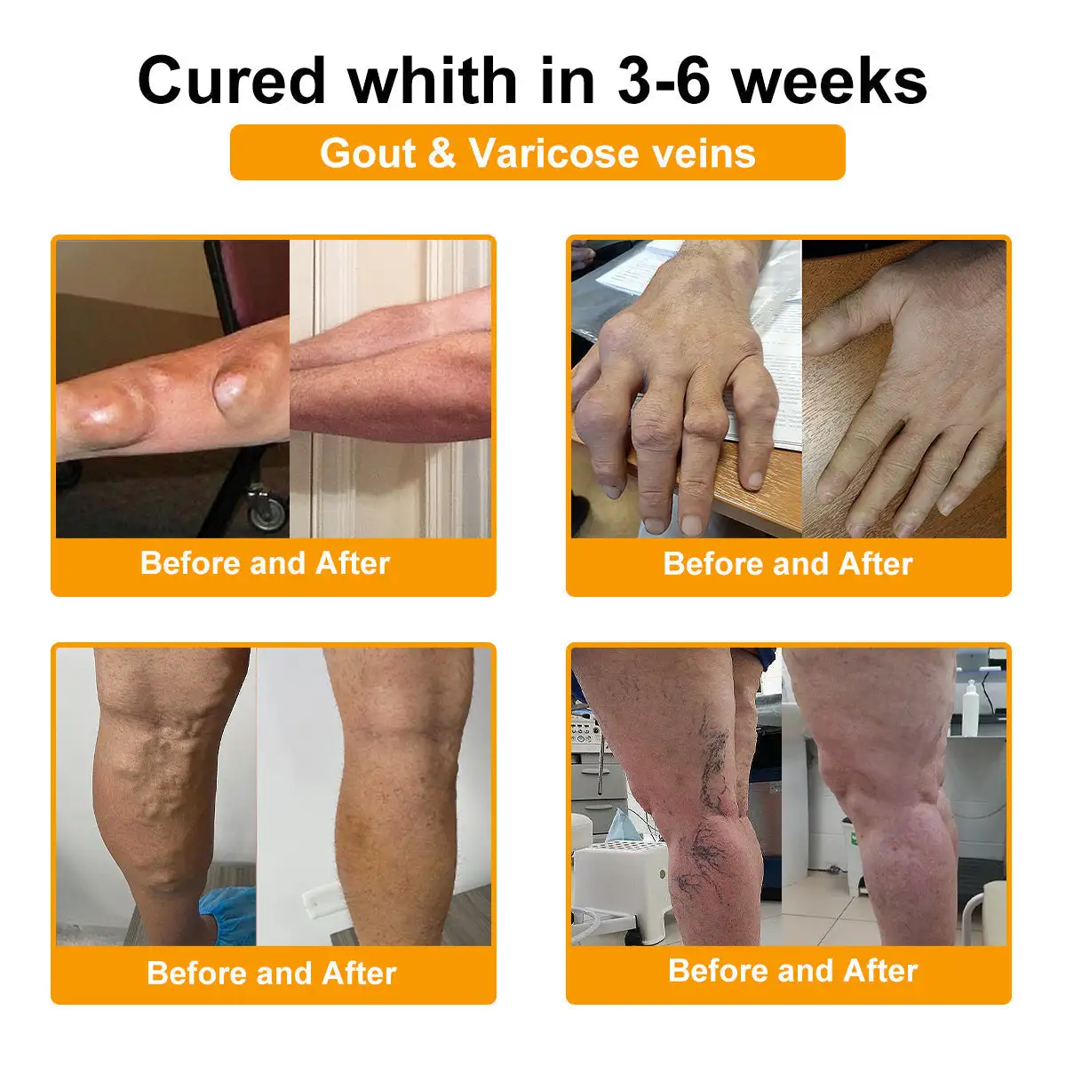 LOTMAY® Bee Venom Pain-Relief Bone Healing Cream