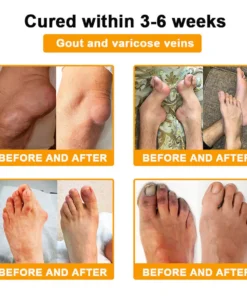 LOTMAY® Bee Venom Pain-Relief Bone Healing Cream