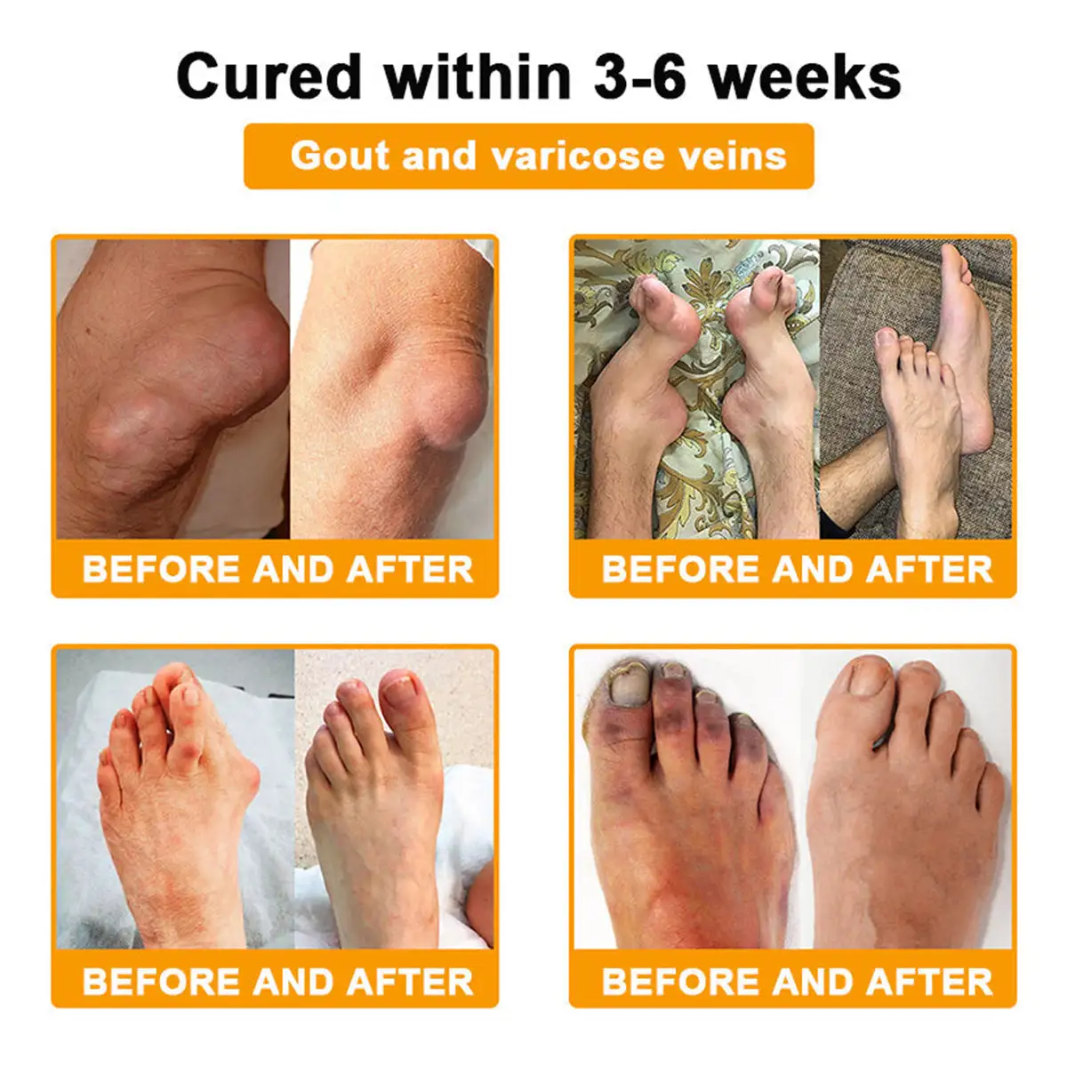 LOTMAY® Bee Venom Pain-Relief Bone Healing Cream