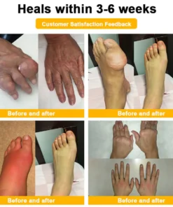 LOTMAY® Bee Venom Pain-Relief Bone Healing Cream