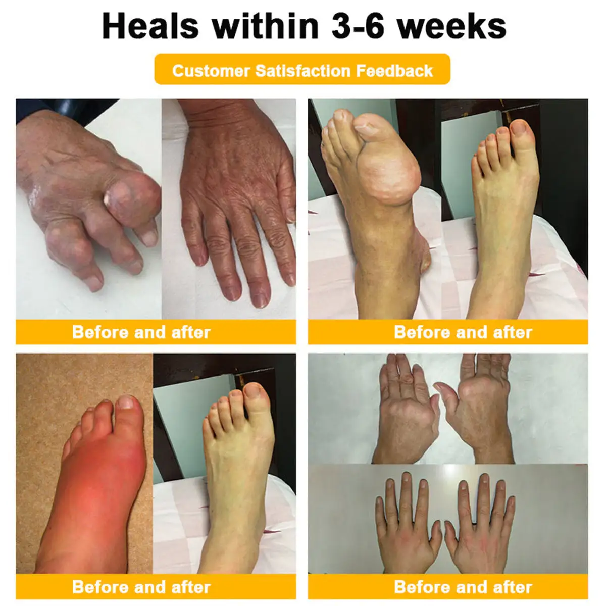 LOTMAY® Bee Venom Pain-Relief Bone Healing Cream