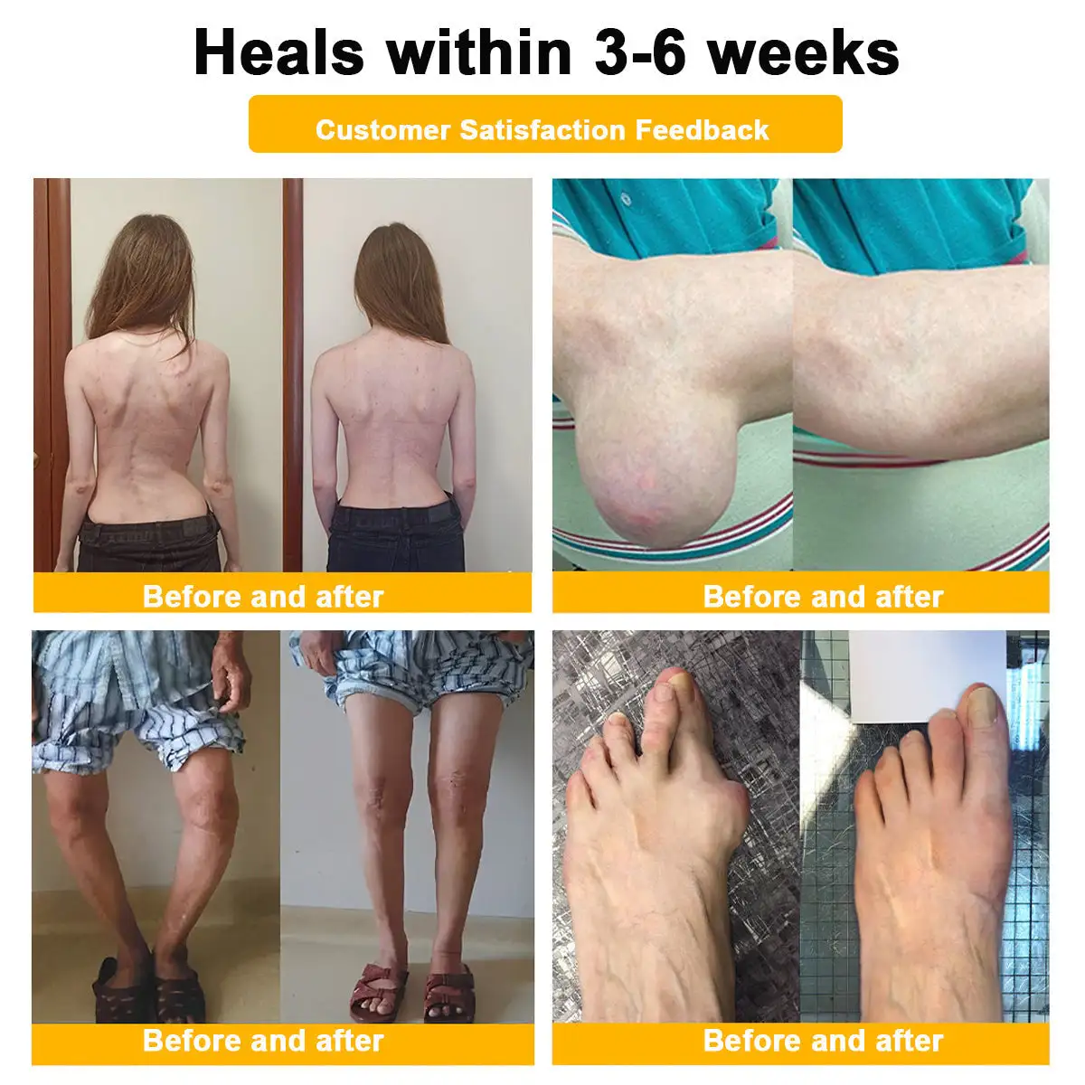 LOTMAY® Bee Venom Pain-Relief Bone Healing Cream