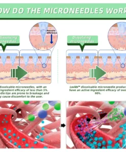 LOVILDS® SMGT-GLP-1 Nano Microneedle Patch