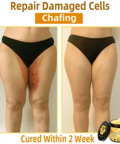 STDEI® APIS VENENUMREPAIR BALM