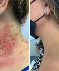 STDEI® APIS VENENUMREPAIR BALM