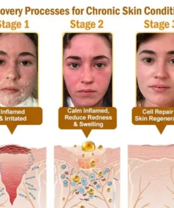 STDEI® APIS VENENUMREPAIR BALM