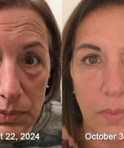 STDEI® APIS VENENUMREPAIR BALM